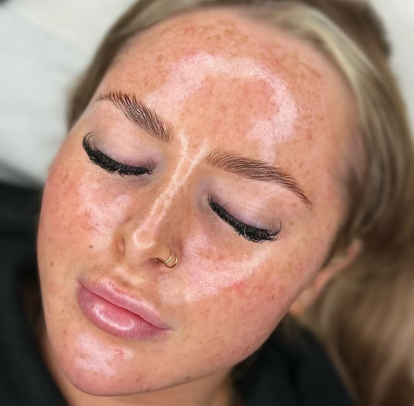 Steamboat Aviator | Can Dermaplaning Permanently Remove Facial Hair? Aftercare Tips for Smooth, Calm Skin