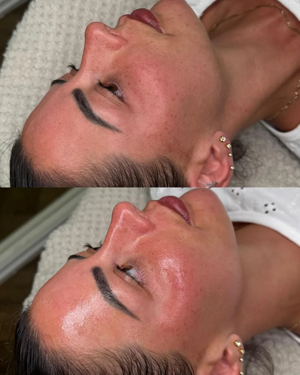 Steamboat Aviator | Can Dermaplaning Permanently Remove Facial Hair? How Often Is Too Often