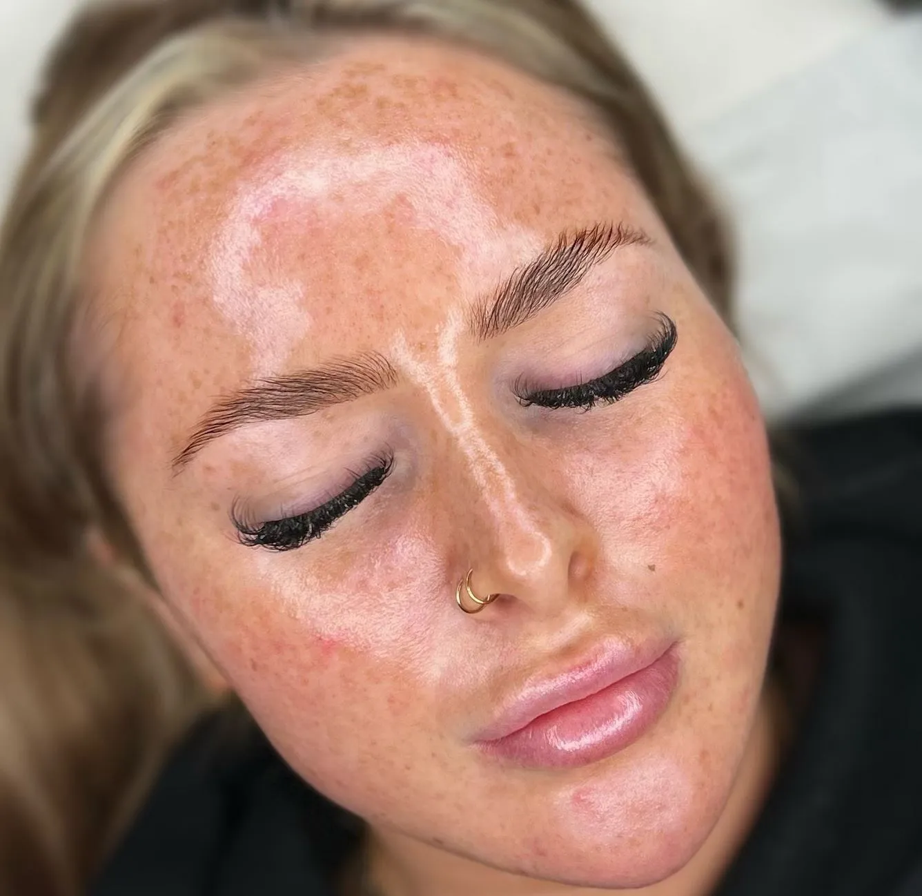 Steamboat Aviator | Can Dermaplaning Permanently Remove Facial Hair? What Does the Treatment Feel Like