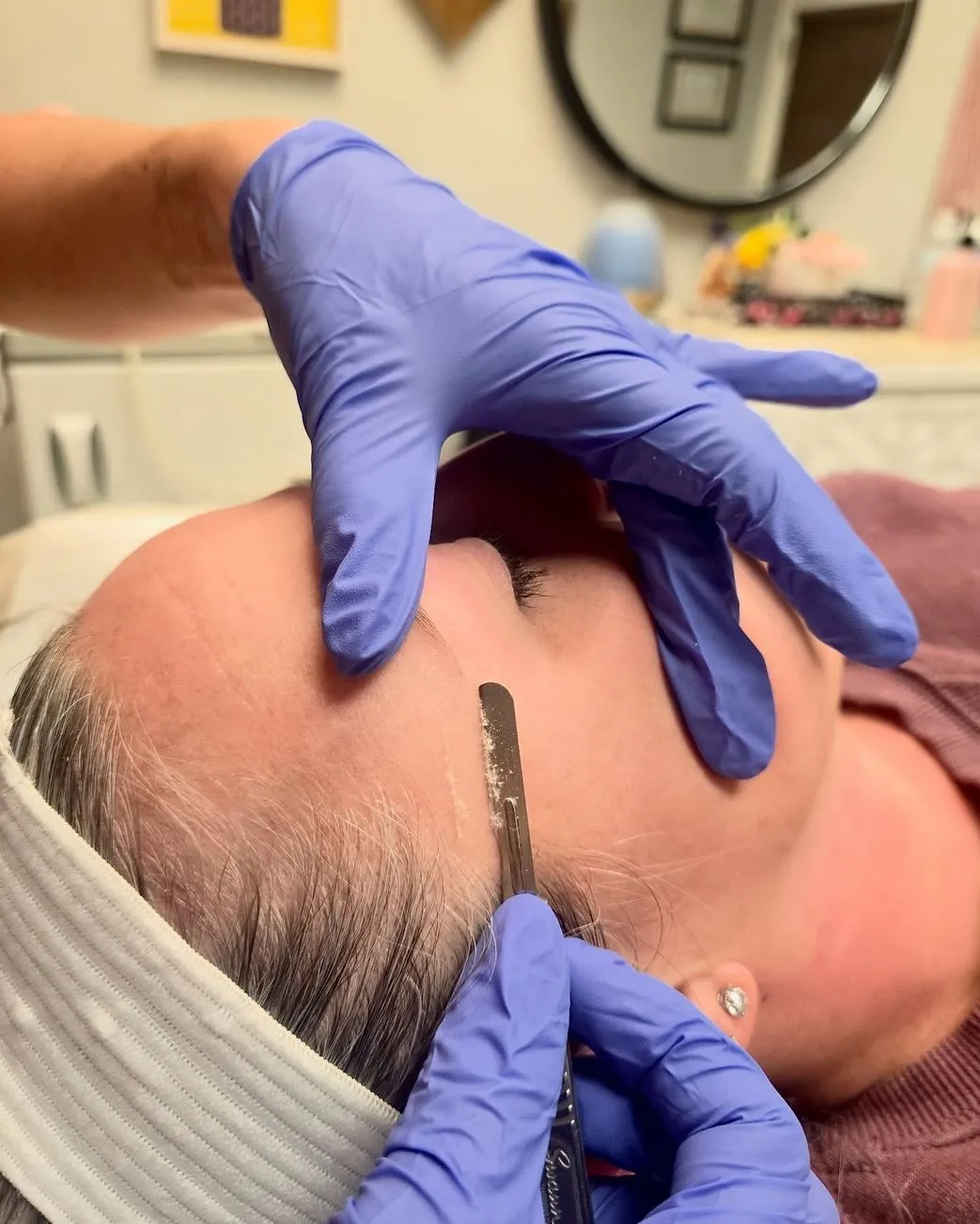 Steamboat Aviator | Can Dermaplaning Permanently Remove Facial Hair? What It Is & How It Works