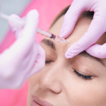 Erase Glabellar Lines Naturally: Alternatives to Botox for Smoother Skin